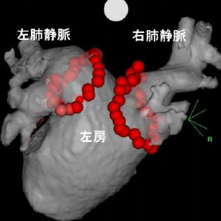 高周波