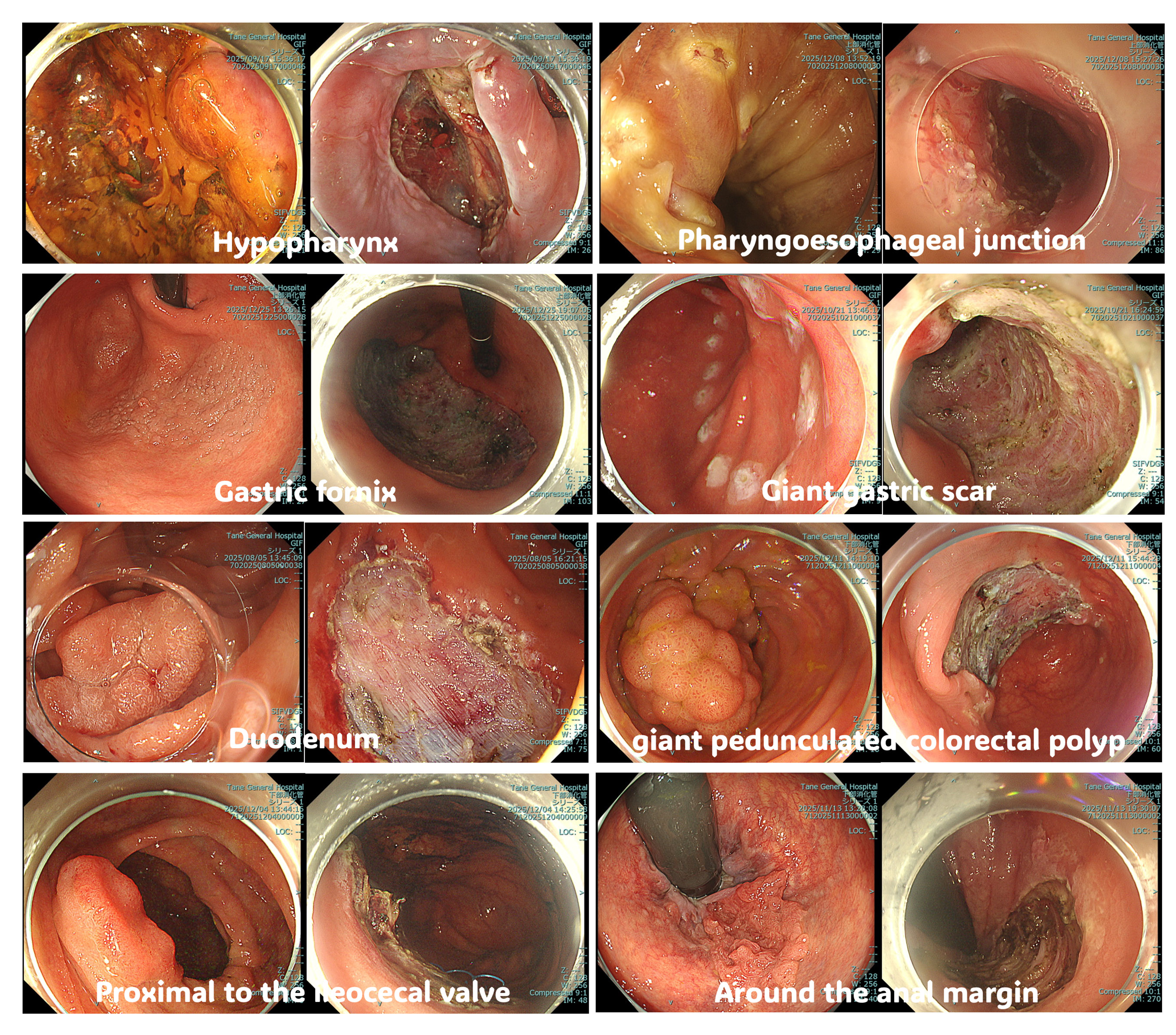 Comparison with surgery