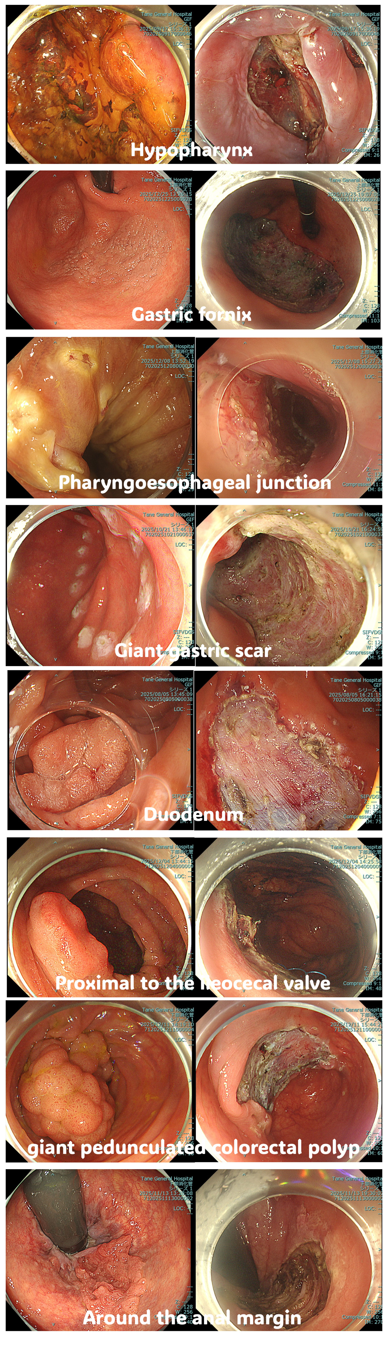 Comparison with surgery